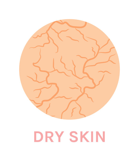 drought