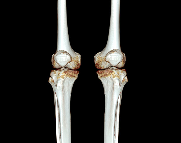 tibia