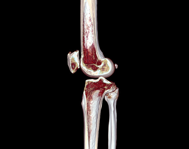 tibia