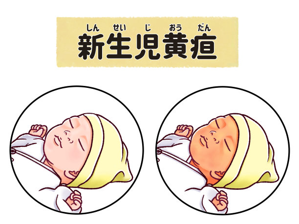 newborn
