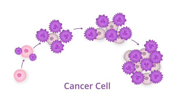 cancer