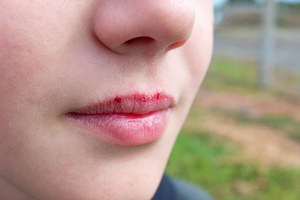 lip
