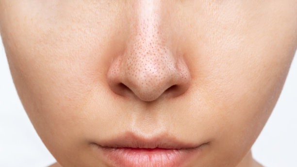 pores