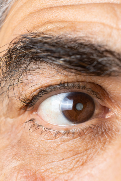 retina