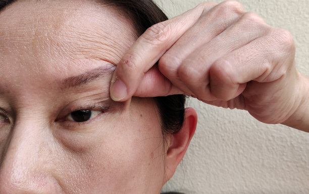 wrinkles