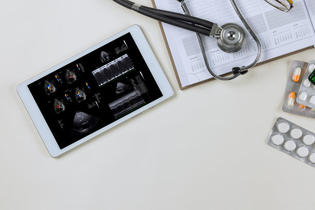 ekg