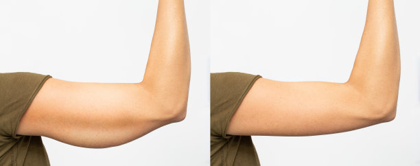 arms