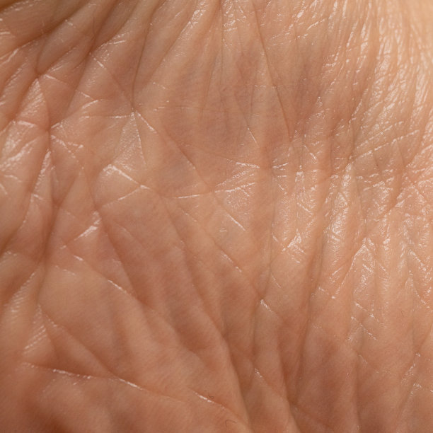 pores
