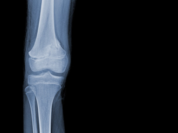 tibia