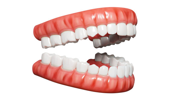 dental