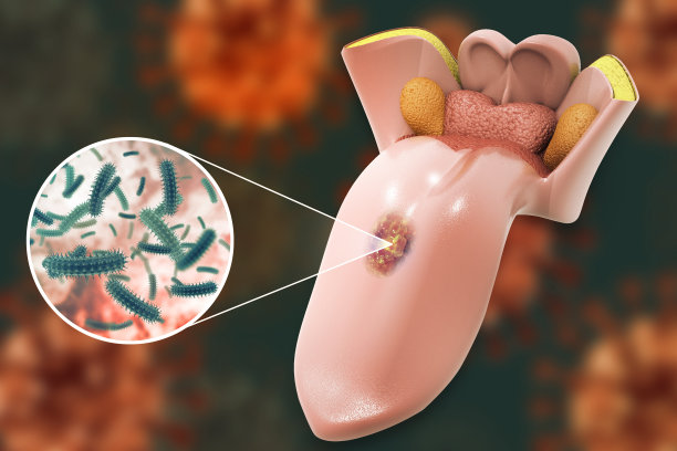 inflammation