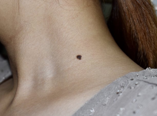 mole
