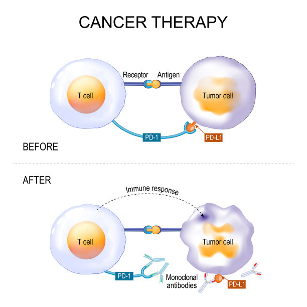 cancer