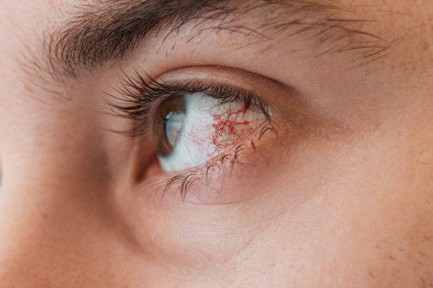 eye