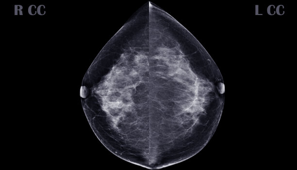 breast