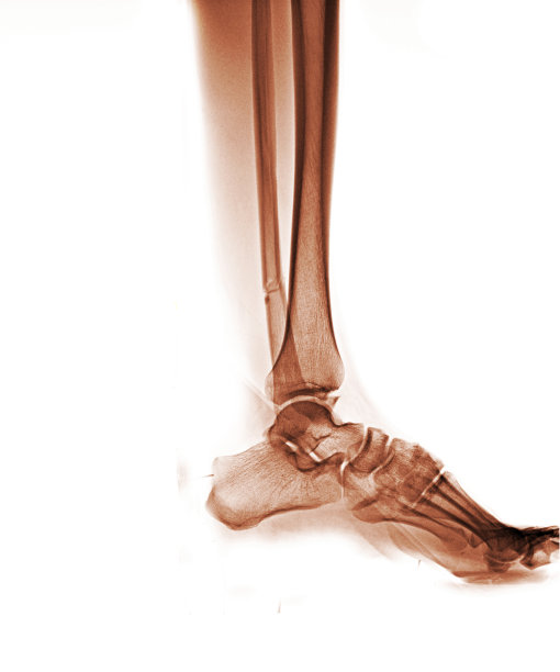 tibia