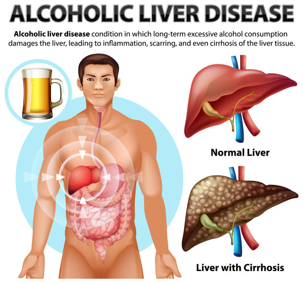 什么是病毒性肝炎