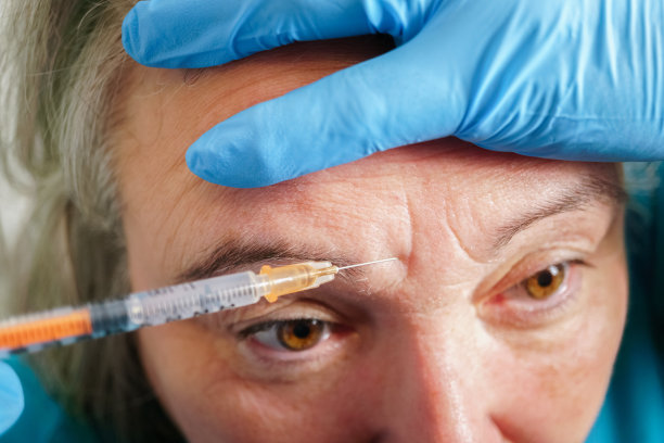 botox
