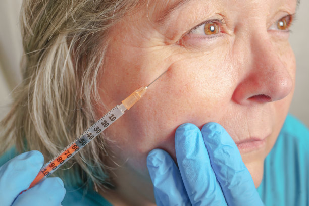 botox