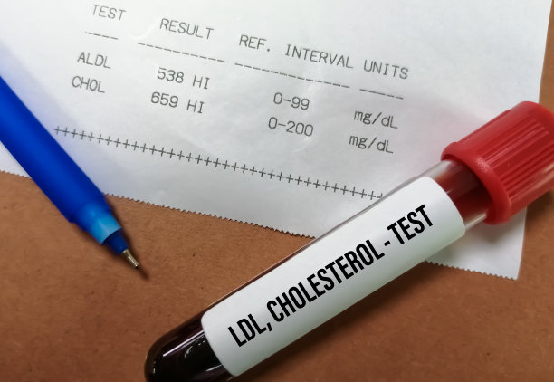 cholesterol
