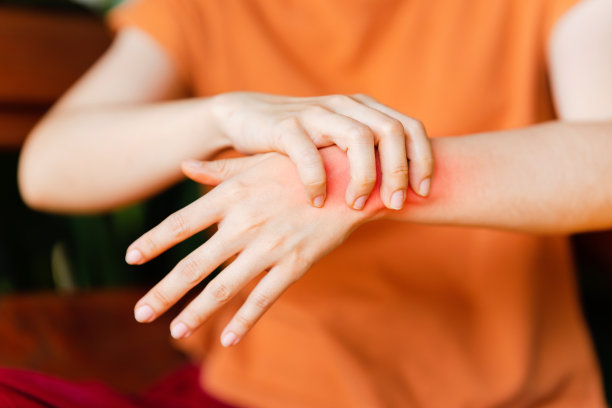 arthritis