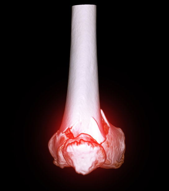 tibia