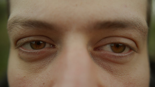 stare