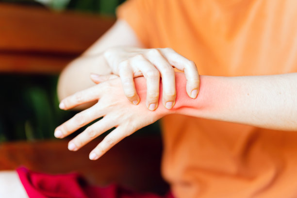 inflammation