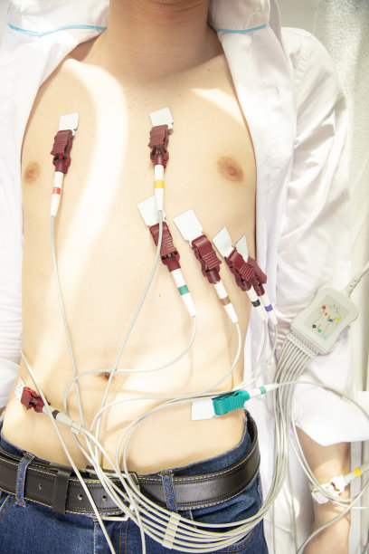 ekg