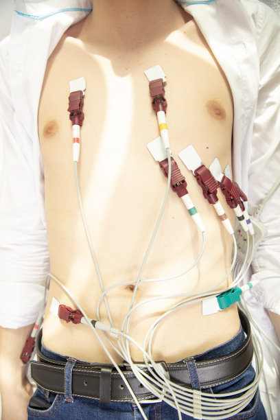 ekg