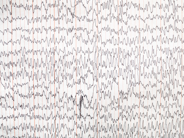 eeg
