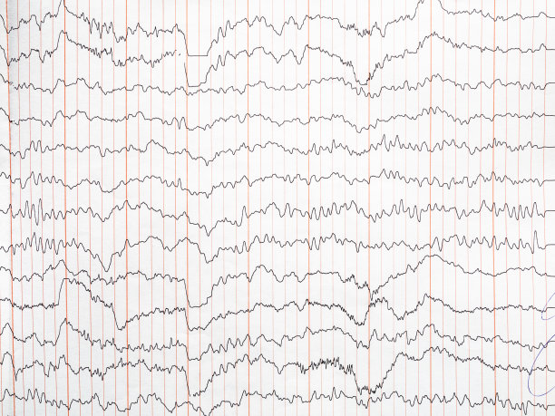 eeg