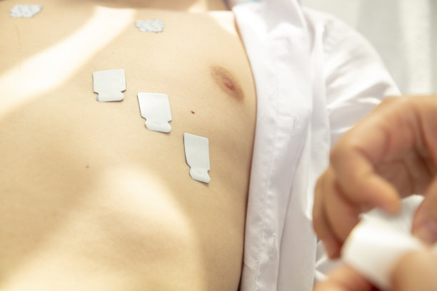 ekg