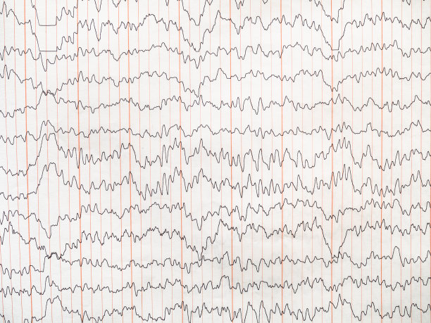 eeg