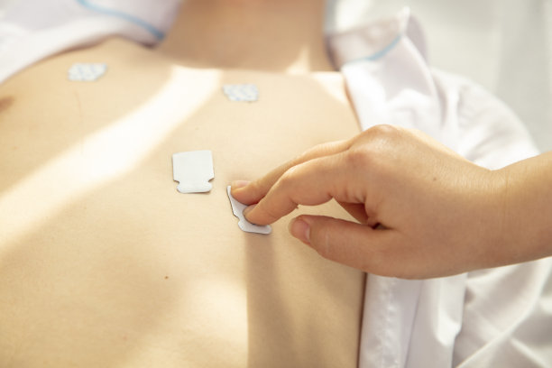 ekg
