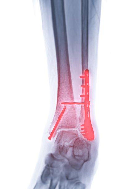 tibia