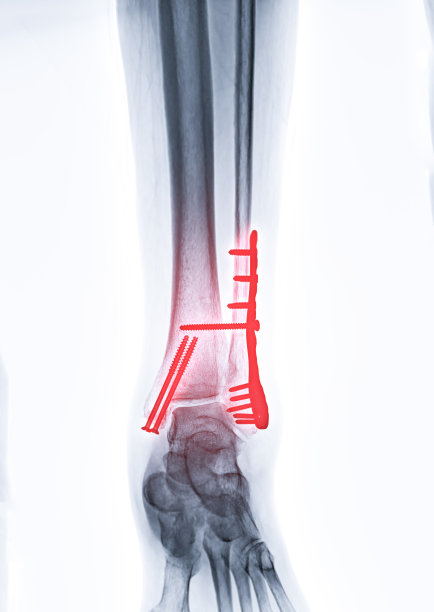 tibia