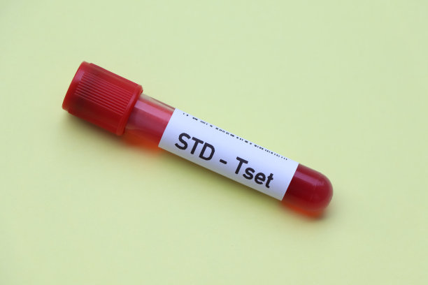 std