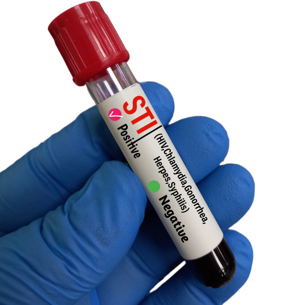 std