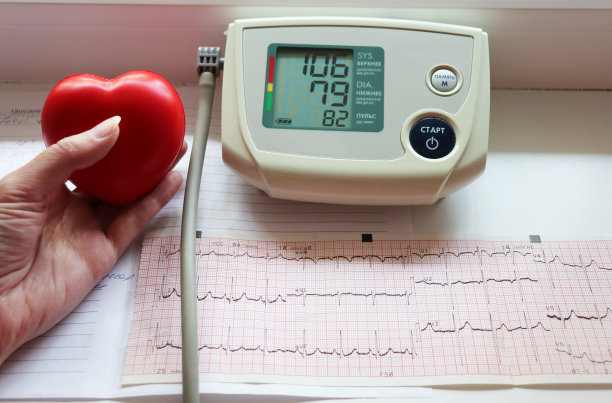 ekg