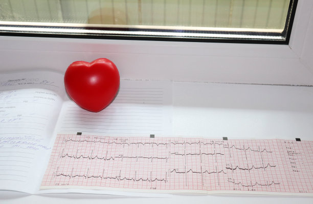 ekg