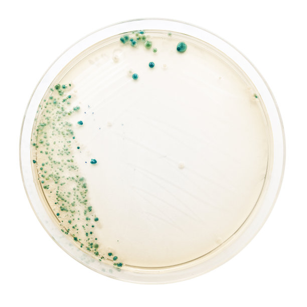 bacteria