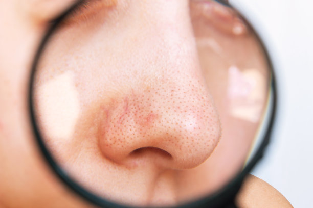 pores