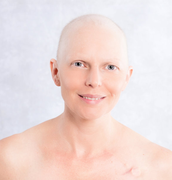 cancer