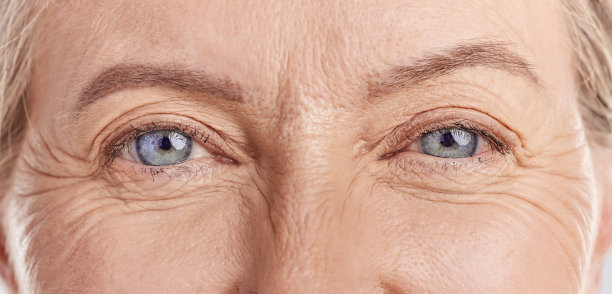 wrinkles