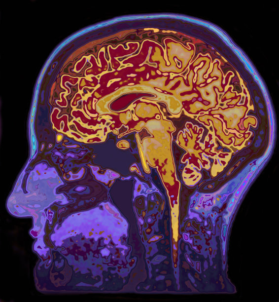 brain