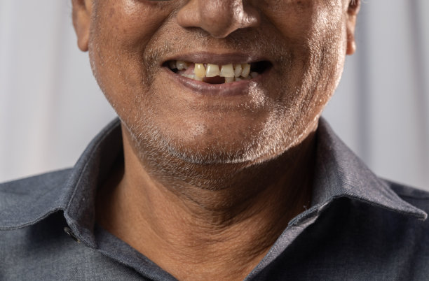 gap