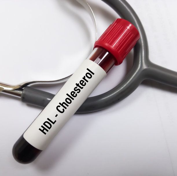 cholesterol