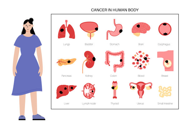 cancer