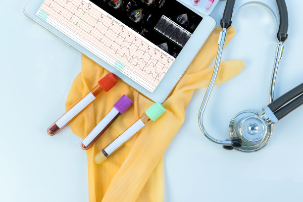 ekg